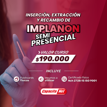 curso de implanon alt.
