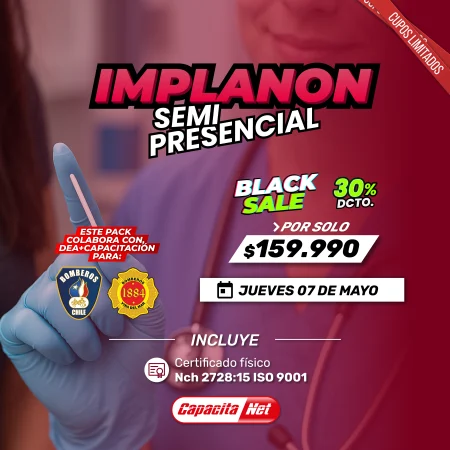 CURSO DE IMPLANON SEMIPRESENCIAL (CON FANTOMAS) - SANTIAGO (07/05/26)