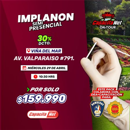 CURSO DE IMPLANON SEMIPRESENCIAL (CON FANTOMAS) - VIÑA DEL MAR - 29/04/2026