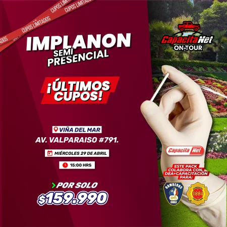 CURSO DE IMPLANON SEMIPRESENCIAL (CON FANTOMAS) - VIÑA DEL MAR 3PM (TURNO TARDE) - 29/04/2026