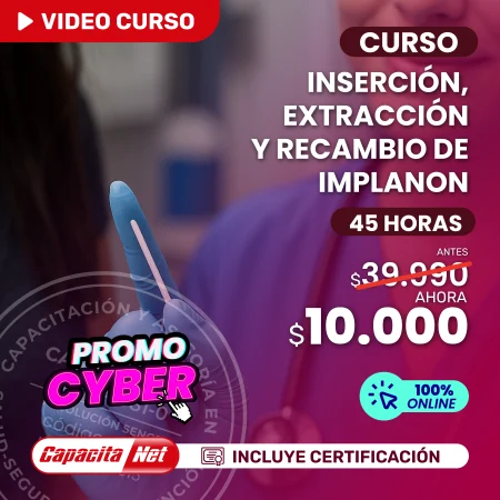 Curso de inserción, extracción y recambio de implanon 45 Hrs