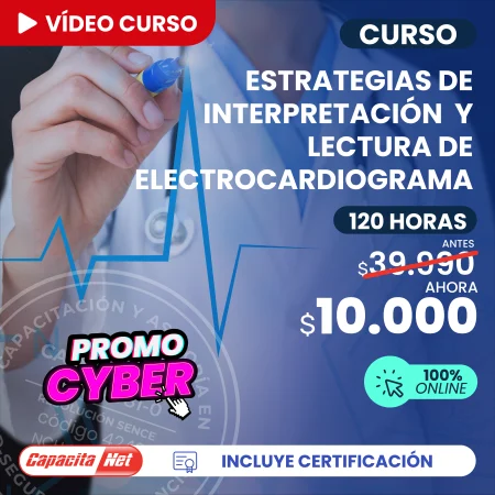 Curso de Interpretación y lectura de electrocardiograma 120 hrs